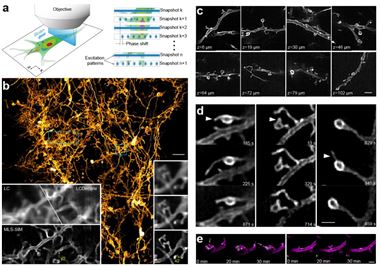 我国科研人员开发出清醒动物超分辨光学显微成像技术